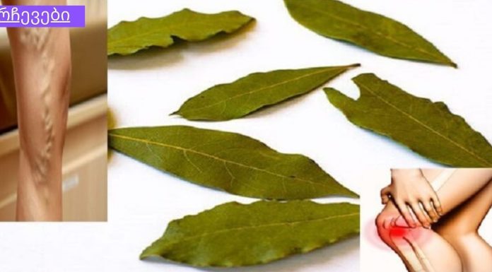 ამ უმარტივესი მეთოდით დაივიწყეთ ვენების ვარიკოზული გაგანიერება და სხვა ჩამოთვლილი დაავადებები.