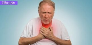 5 გამაფრთხილებელი ნიშანი გარდაუვალი გულის შეტევის შესახებ, რომლებიც არ უნდა უგულებელყოთ!