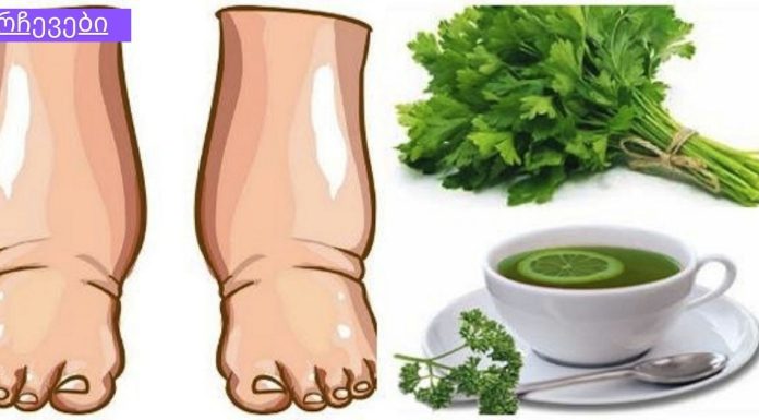 ეს ძლიერი სახლში მომზადებული ჩაი განკურნავს შეშუპებულ ფეხებს რამდენიმე დღეში.