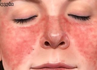 7 ნიშანი იმისა, რომ თქვენი კანი გაფრთხილებთ სერიოზულ დაავადებებზე