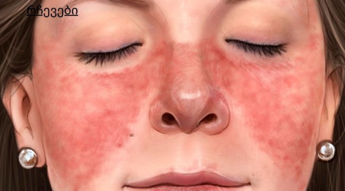 7 ნიშანი იმისა, რომ თქვენი კანი გაფრთხილებთ სერიოზულ დაავადებებზე