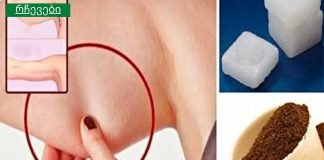 დაივიწყეთ ნაოჭებიანი კისერი, ჩამოშლილი ხელები და მოშვებული ბარძაყები!