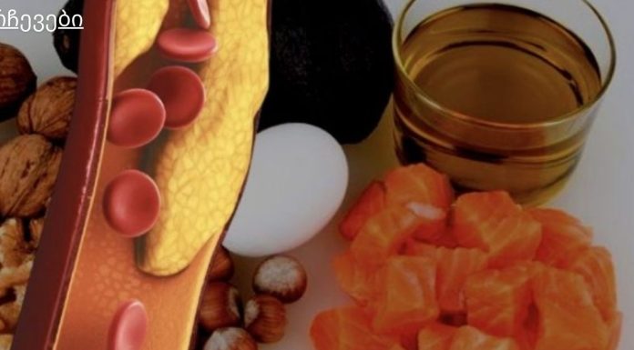 მნიშვნელოვანი, მაგრამ ნაკლებად ცნობილი ფაქტები ქოლესტერინის შესახებ.