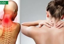 6 მარტივი, მაგრამ ეფექტური ნაბიჯი, რომელიც აუცილებლად მოგიხსნით კისრის ტკივილს!