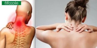 6 მარტივი, მაგრამ ეფექტური ნაბიჯი, რომელიც აუცილებლად მოგიხსნით კისრის ტკივილს!