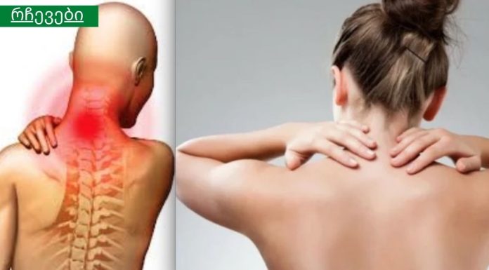 6 მარტივი, მაგრამ ეფექტური ნაბიჯი, რომელიც აუცილებლად მოგიხსნით კისრის ტკივილს!
