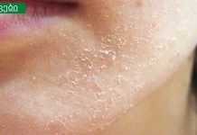 15 მნიშვნელოვანი ორგანიზმის სიგნალი,რომელსაც ყურადღება უნდა მიაქციოთ. როგორ “ყვირის: სხეული დახმარებისთვის