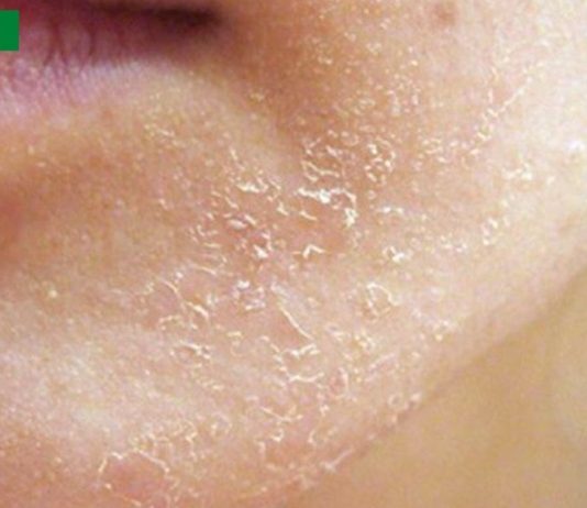 15 მნიშვნელოვანი ორგანიზმის სიგნალი,რომელსაც ყურადღება უნდა მიაქციოთ. როგორ “ყვირის: სხეული დახმარებისთვის