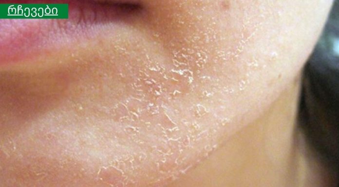 15 მნიშვნელოვანი ორგანიზმის სიგნალი,რომელსაც ყურადღება უნდა მიაქციოთ. როგორ “ყვირის: სხეული დახმარებისთვის