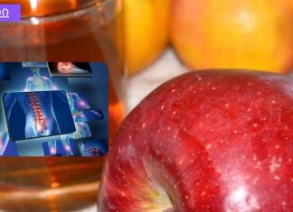 ვაშლის ძმრით სახსრების ეფექტური მკურნალობის რეცეპტები