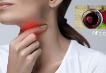 ბუნებრივი საშინაო საშუალება ყელის ტკივილისთვის