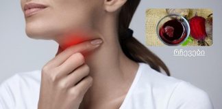 ბუნებრივი საშინაო საშუალება ყელის ტკივილისთვის