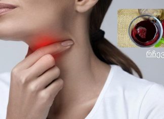 ბუნებრივი საშინაო საშუალება ყელის ტკივილისთვის