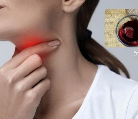 ბუნებრივი საშინაო საშუალება ყელის ტკივილისთვის