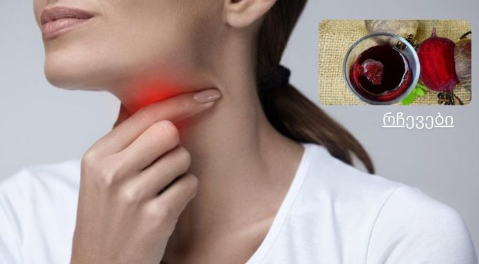 ბუნებრივი საშინაო საშუალება ყელის ტკივილისთვის