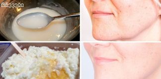 გამოიყენეთ ეს კვირაში ერთხელ, რათა თქვენი სახე 10 წლით ახალგაზრდულად გამოიყურებოდეს.