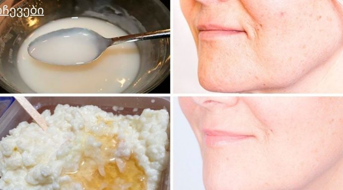 გამოიყენეთ ეს კვირაში ერთხელ, რათა თქვენი სახე 10 წლით ახალგაზრდულად გამოიყურებოდეს.