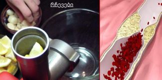 დადასტურებული რეცეპტი! მხოლოდ 1 კოვზი უზმოზე და თქვენი ორგანიზმი გასუფთავდება.