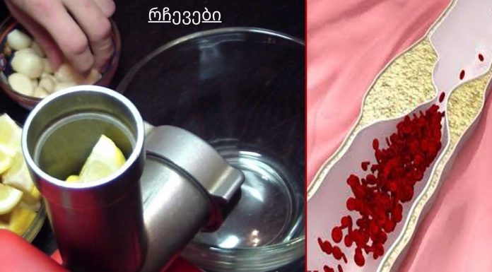 დადასტურებული რეცეპტი! მხოლოდ 1 კოვზი უზმოზე და თქვენი ორგანიზმი გასუფთავდება.