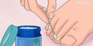 ექვსი ძლიერი საშუალება ხფრჩხილის სოკოს მოსაშორებლად