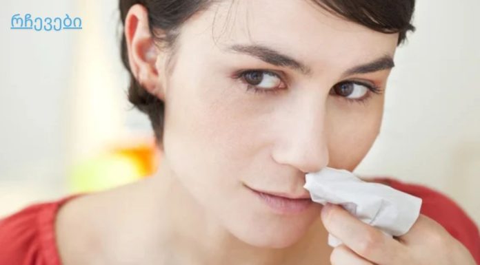 ცხვირიდან სისხლდენა – მიზეზები და პირველადი დახმარება