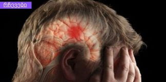 გულის პრობლემები და ინსულტი: მხოლოდ 3 ნაბიჯი გადაარჩენს თქვენ და თქვენს ახლობლებს.კარდიოლოგები ირწმუნებიან, რომ ვინც ამ ინფორმაციას წაიკითხავს და 10 ადამიანს გაუგზავნის, დარწმუნებული უნდა იყოს, რომ ერთი სიცოცხლე მაინც გადაარჩინა!