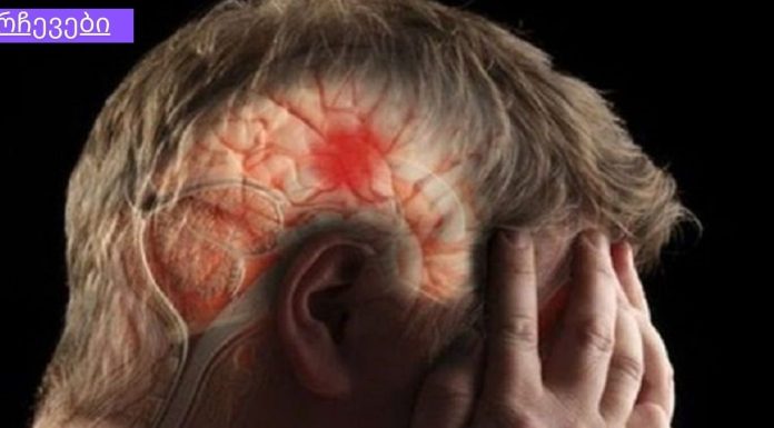 გულის პრობლემები და ინსულტი: მხოლოდ 3 ნაბიჯი გადაარჩენს თქვენ და თქვენს ახლობლებს.კარდიოლოგები ირწმუნებიან, რომ ვინც ამ ინფორმაციას წაიკითხავს და 10 ადამიანს გაუგზავნის, დარწმუნებული უნდა იყოს, რომ ერთი სიცოცხლე მაინც გადაარჩინა!