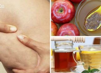 ნიორი და ფორთოხლი – მთავარი საშუალება ვარიკოზული ვენებისთვის