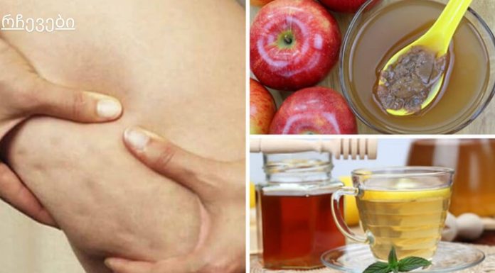 ნიორი და ფორთოხლი – მთავარი საშუალება ვარიკოზული ვენებისთვის