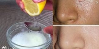 უბრალოდ გამოიყენეთ ეს 2 ინგრედიენტი და თქვენი ფორები სამუდამოდ გაქრება და თქვენი სახე იქნება უფრო სუფთა, ვიდრე ოდესმე!