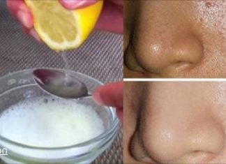 უბრალოდ გამოიყენეთ ეს 2 ინგრედიენტი და თქვენი ფორები სამუდამოდ გაქრება და თქვენი სახე იქნება უფრო სუფთა, ვიდრე ოდესმე!