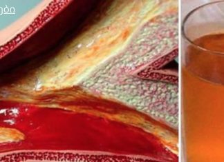 კინაღამ მოვკვდი გულის შეტევით დახშული არტერიების გამო, მაგრამ ეს სასმელი დამეხმარა მათ გაწმენდაში!