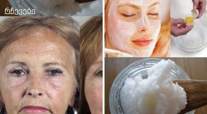 ის ბოტოქსზე უკეთ ამკვრივებს კანს: ეს 3 ინგრედიენტისგან შემდგარი სახის ნიღაბი 10 წლით ახალგაზრდას გახდით!