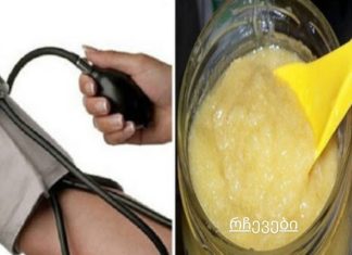 არ დახარჯოთ ფული მაღალი წნევისა და ქოლესტერინის წამლებზე, სცადეთ ამიშის ეს საშუალება!