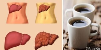 ყავას ვსვამ, რომ ღვიძლი ტოქსინებისგან გადავარჩინო! ალკოჰოლის მიღების შემდეგ მნიშვნელოვანია…