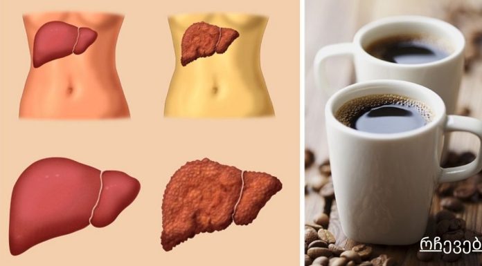 ყავას ვსვამ, რომ ღვიძლი ტოქსინებისგან გადავარჩინო! ალკოჰოლის მიღების შემდეგ მნიშვნელოვანია…