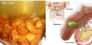 მეცნიერებმა ღვიძლის გაწმენდის საუკეთესო საშუალება აღმოაჩინეს!