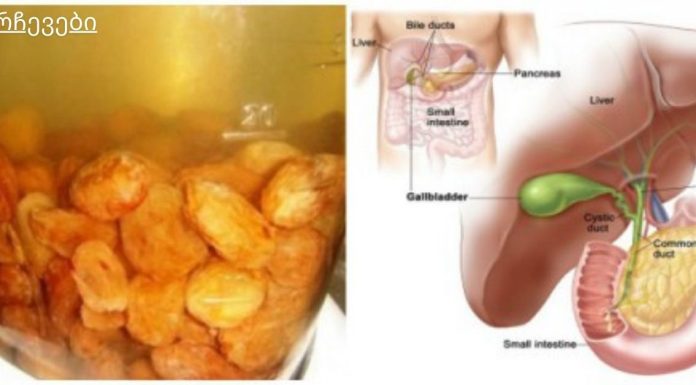 მეცნიერებმა ღვიძლის გაწმენდის საუკეთესო საშუალება აღმოაჩინეს!