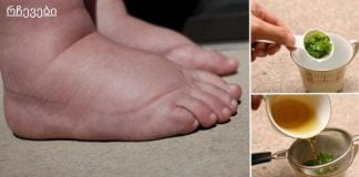 მე გამუდმებით ვიტანჯებოდი ფეხების გასიებით, სანამ არ შევისწავლე ამ სახლის ჩაის შესახებ! შეშუპება გაქრა რამდენიმე დღეში და აღარ მაწუხებს!