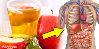 ვაშლის ძმარი წონის დაკარგვის ყველაზე ჯანსაღი იარაღია!