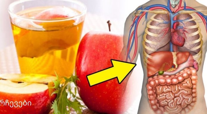 ვაშლის ძმარი წონის დაკარგვის ყველაზე ჯანსაღი იარაღია!