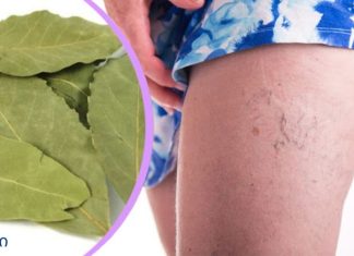 ამ ფოთლების წყალობით თქვენ მოგიხსნით ვარიკოზულ ვენებს, მეხსიერების პრობლემებს და თავის ტკივილს!