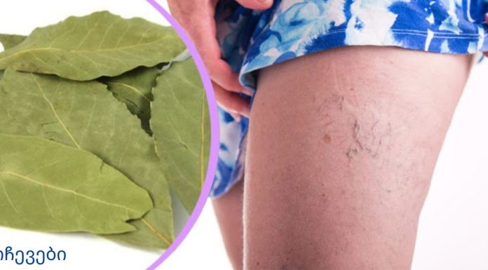 ამ ფოთლების წყალობით თქვენ მოგიხსნით ვარიკოზულ ვენებს, მეხსიერების პრობლემებს და თავის ტკივილს!