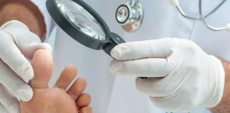 საუკეთესო საშინაო საშუალებები ფრჩხილის სოკოს მოსაშორებლად!