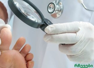 საუკეთესო საშინაო საშუალებები ფრჩხილის სოკოს მოსაშორებლად!