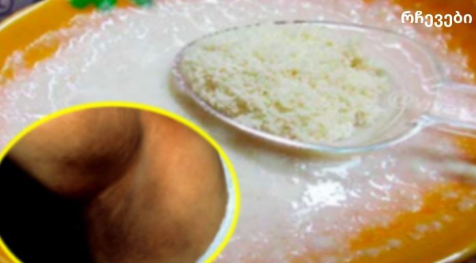 საბედნიეროდ კანი ამ ბუნებრივი მეთოდით გავათეთრე!ჩემი იღლია, კისერი და მუხლი შავი იყო.