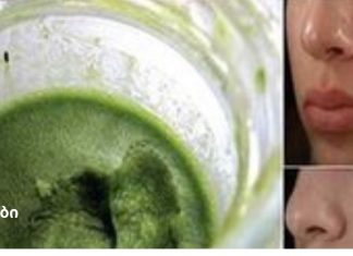 ეს მწვანე პასტა მოგაცილებთ ნაწიბურებს სახიდან მხოლოდ 3 დღეში!