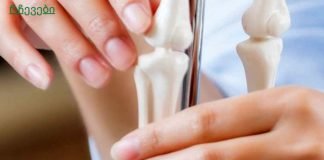 რა არის ძვლის რეზორბცია? ძვლის დაკარგვა გამოწვეულია იმუნური სისტემით?