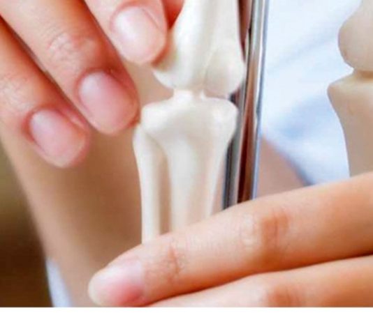 რა არის ძვლის რეზორბცია? ძვლის დაკარგვა გამოწვეულია იმუნური სისტემით?