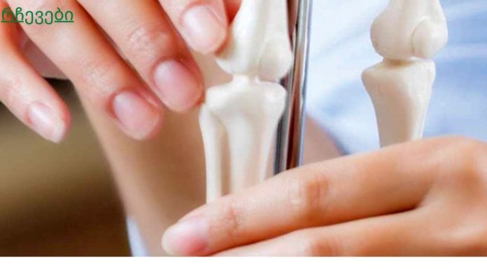 რა არის ძვლის რეზორბცია? ძვლის დაკარგვა გამოწვეულია იმუნური სისტემით?